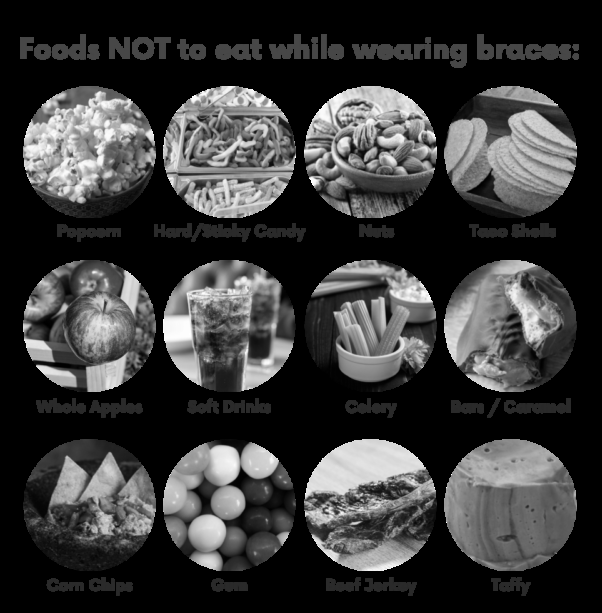 Best foods to enjoy and foods to avoid when wearing braces image 0